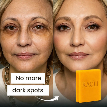 Skin Brightening Bar